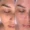 Hydrafacial Alger - EPILIA